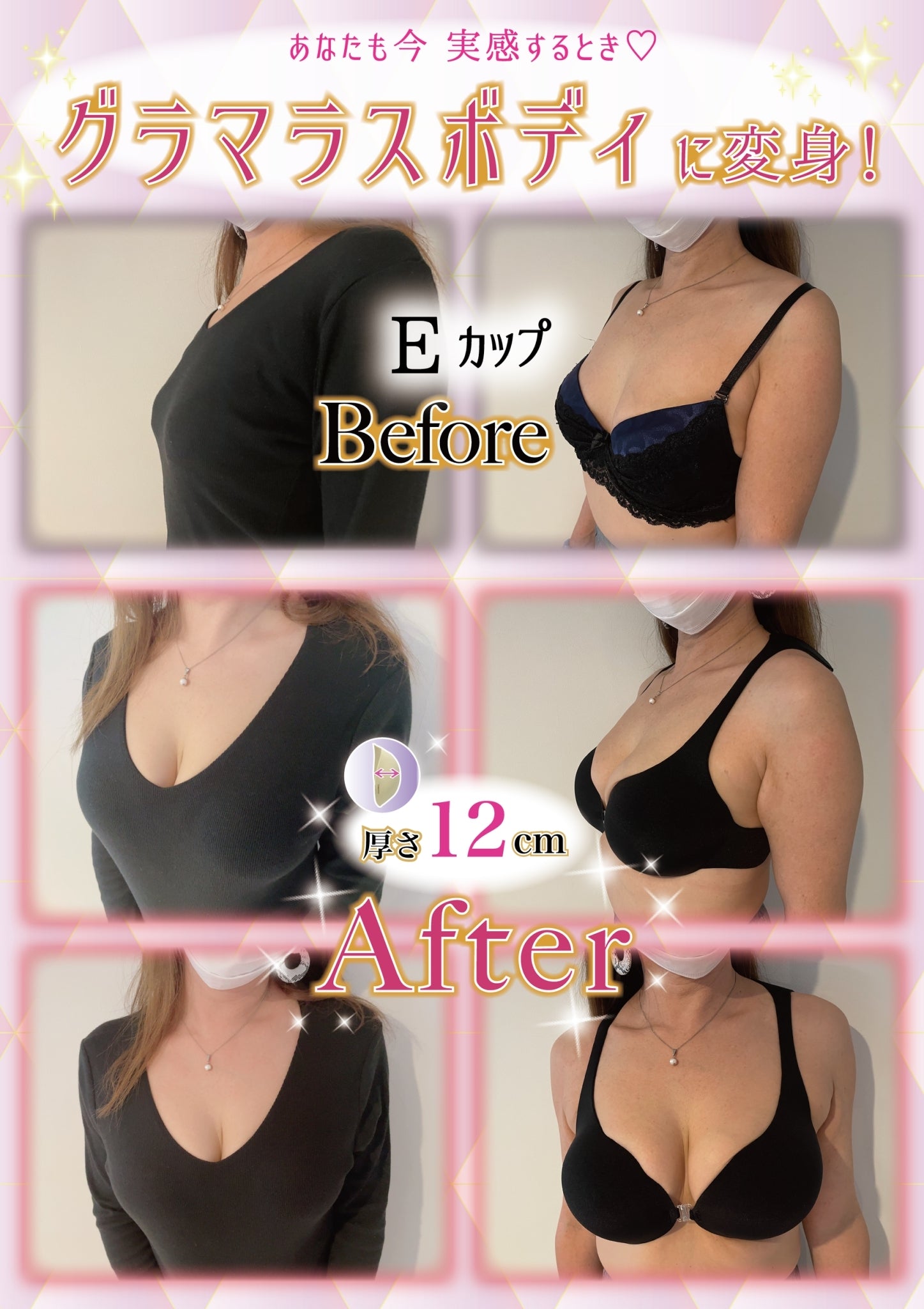 Mirai Pai Pads, a stick-on bra for women, perfect for creating the perfect bust. Perfect for Halloween costumes, summer and spring wear, and post-mastectomy breast cancer treatments.